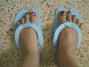 Gout Support Group Image