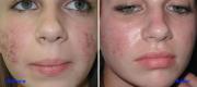 Skin Hair & Nail Diseases Image